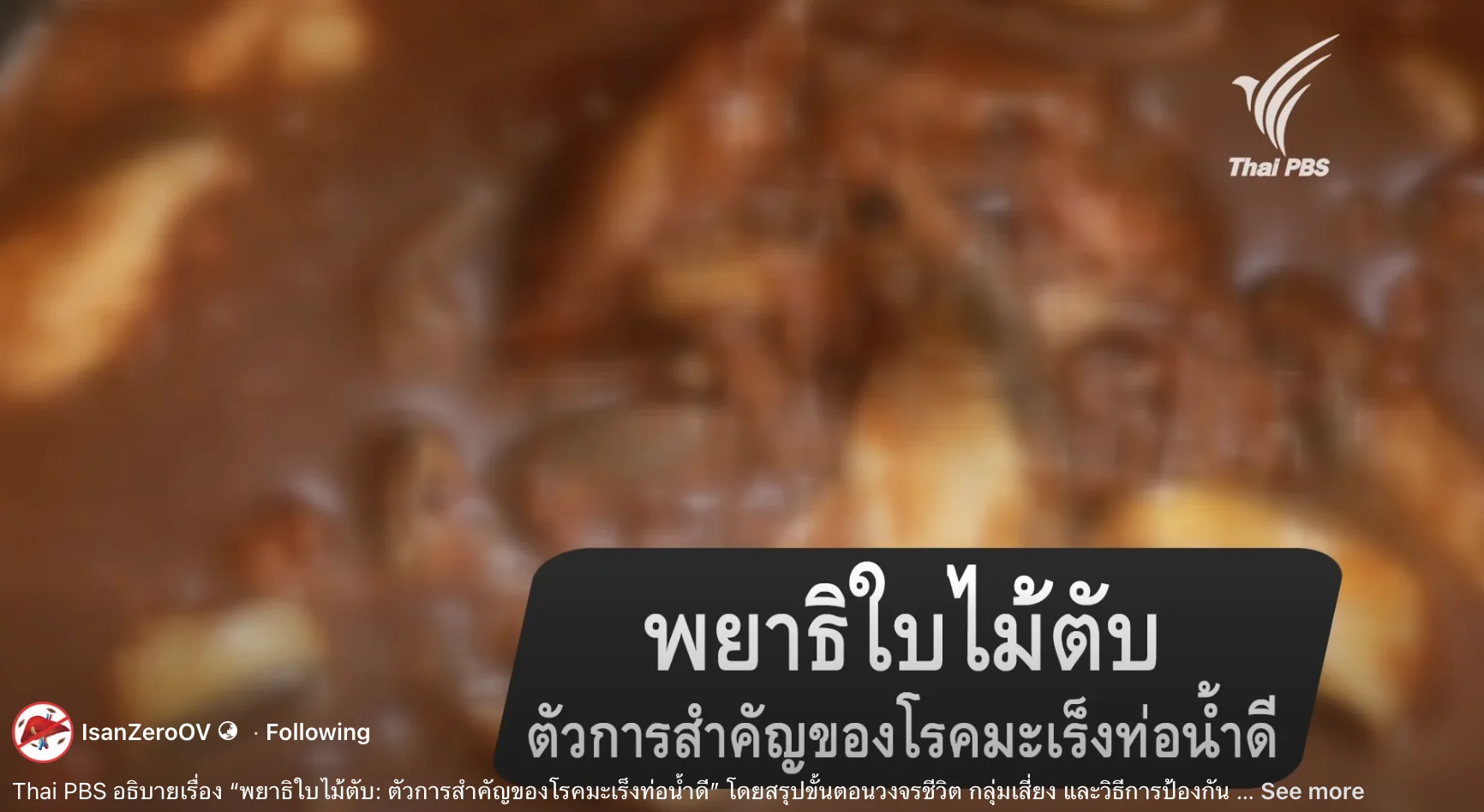 Thai PBS อธิบายเรื่อง “พยาธิใบไม้ตับ: ตัวการสำคัญของโรคมะเร็งท่อน้ำดี”