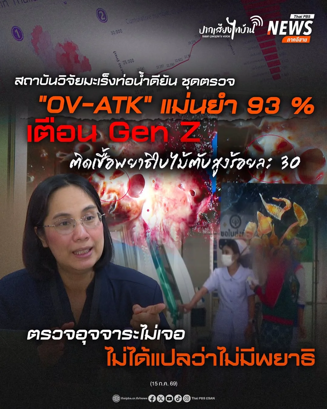 ไทยพีบีเอส เกาะติดกรณีผลตรวจพยาธิใบไม้ตับของนักศึกษาใน จ.มหาสารคาม